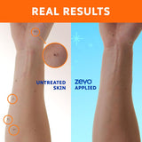 Zevo On-Body Aerosol Spray Insect Repellent Liquid For Mosquitoes/Ticks 6 oz, Pack of 6